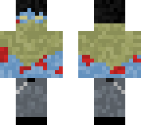 frostbitten wanderer
