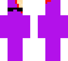 brain dead