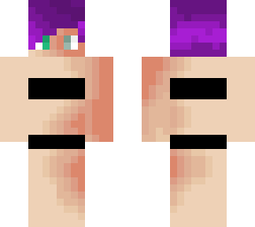 the burn scars