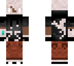 75th skin (bone level)