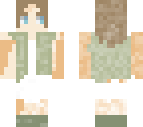 vitiligo<3