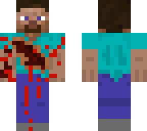 bruised steve