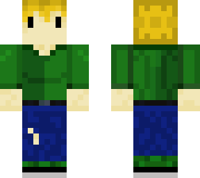 wdym this skin looks like *****? casual