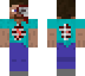 "slightly" injured steve