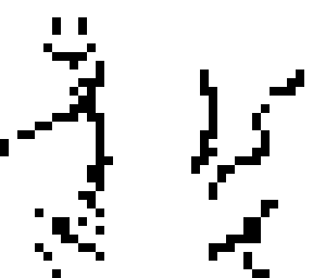 fracture