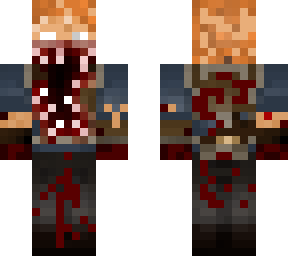 simon netzack skin remodel
