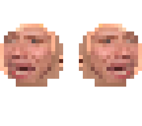 #multibald
