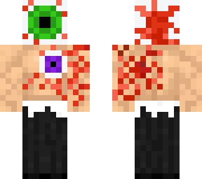 jacked septic eye