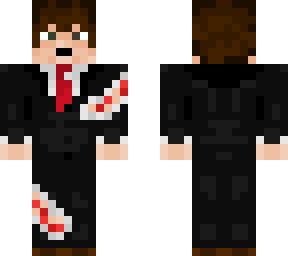 suited hurt man