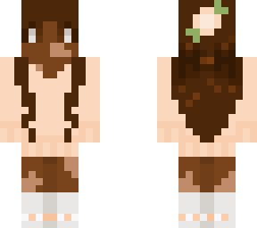 vitiligo girl