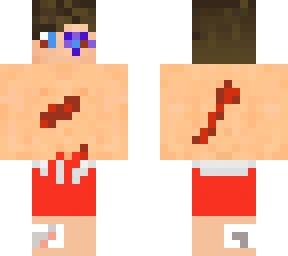 wounded