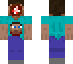 steve-transplantation