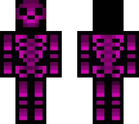 legs fixed
