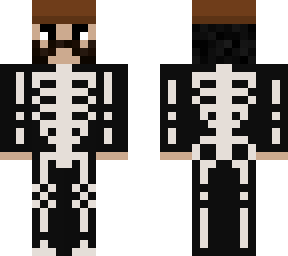 skelirra
