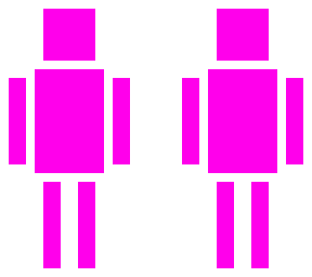 anomaly