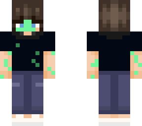 casey (wagttwf)