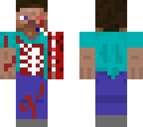 damaged steve