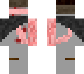 painful guy