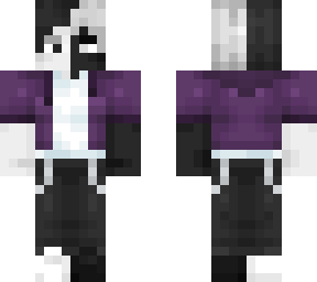 fracture