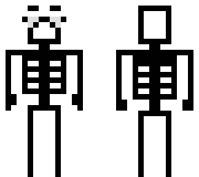 skeleton