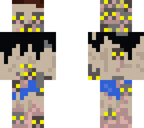 infestation [stage 2]