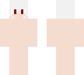 albino human