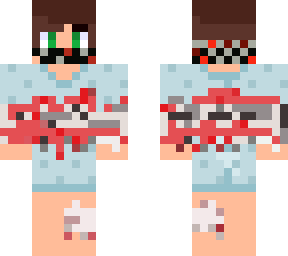 patient 1