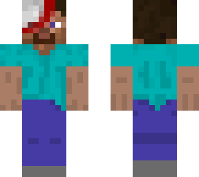 steve injured head