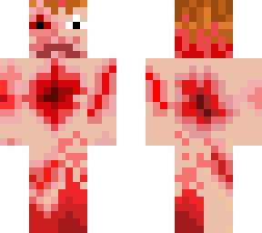 wounded man