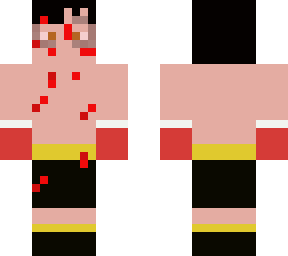 rocky balboa (after fight)  (rocky ii)