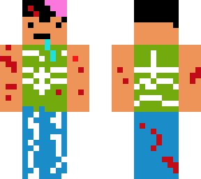 zomby