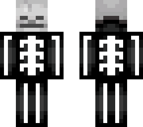 x-ray