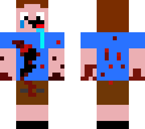 injured noob in drippy pants