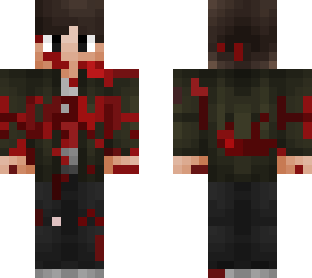 casual fit | v4 injured