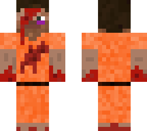injured prisoner