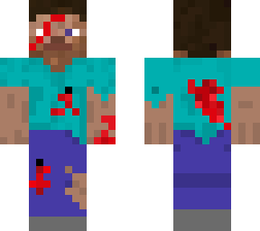 injured steve