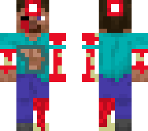 steve injured
