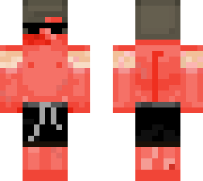 max sunburnt skin