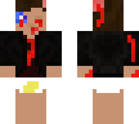 baby nathan attect by zombies