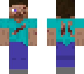 injured steve