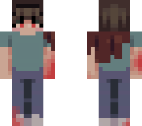 . what happend to steve ? . skintober day 13
