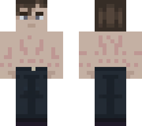 dave miller with scars (not mine)