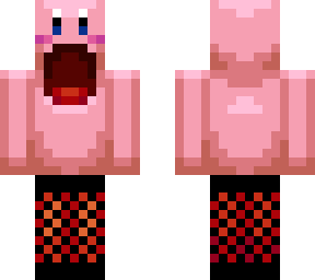 kirby fishnet