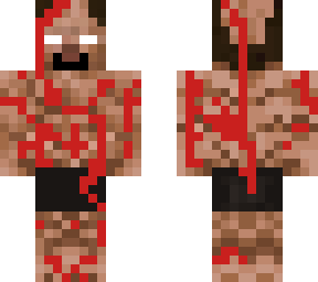 hair loss bloody herobrine