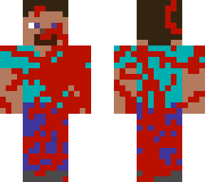 hurt steve