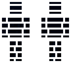 void (2) kb