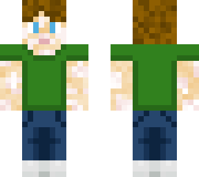 vitiligo brown haired guy