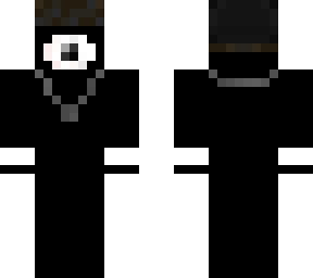 1 eye
