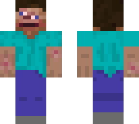 steve when stung by a bee