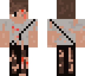 injured survivor
